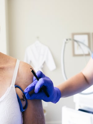 CoolSculpting reducing fat