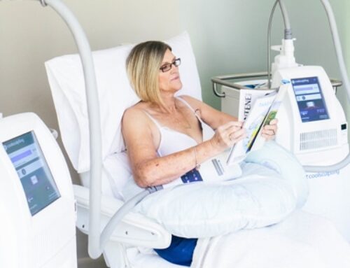 CoolSculpting Recovery Tips: Getting Back to Your Routine