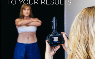 Why CoolSculpting reviews matter