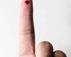 Can I do CoolSculpting if I have diabetes