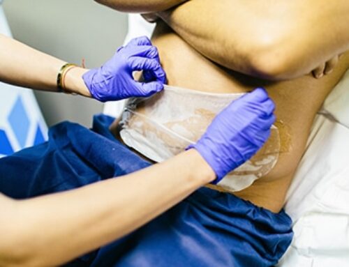 CoolSculpting for Men: Breaking Down Gender Stereotypes With The Bodify
