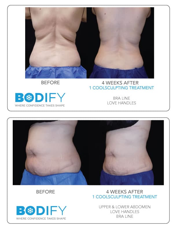 bodify before after