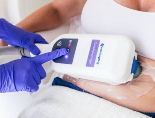 Your Comprehensive Guide to CoolSculpting Safety Protocols