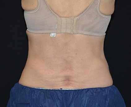 BXA love handles after