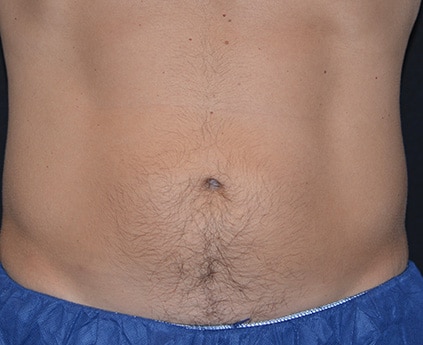 BXA lower abs after
