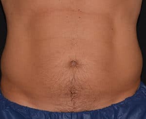 BXA lower abs before