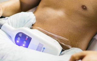 Bodify CoolSculpting treatments mancave man