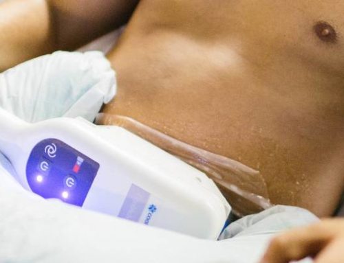 CoolSculpting Elite for Men!