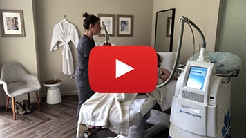 coolsculpting video