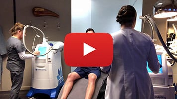 coolsculpting video