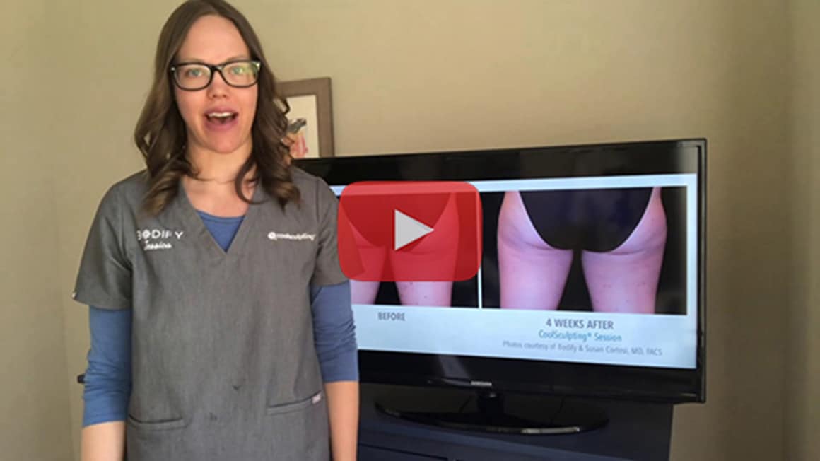 Jessica what is CoolSculpting video