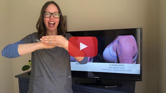 coolsculpting video