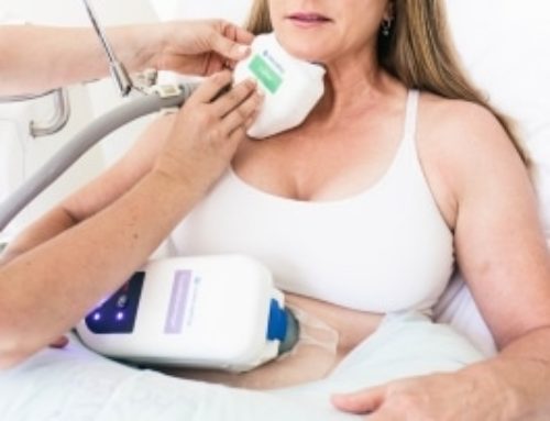 CoolSculpting for Double Chin Reduction