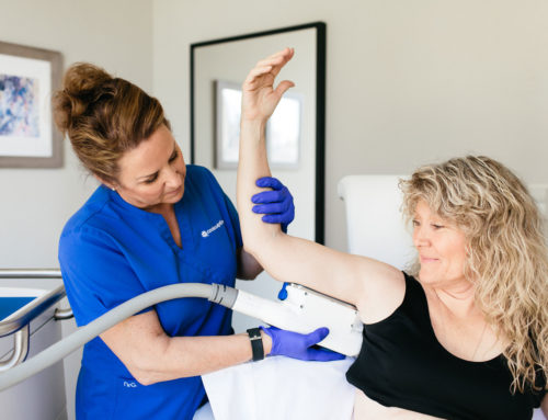Reducing Arm Fat with CoolSculpting Elite