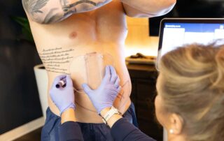 coolsculpting elite fat reduction that works