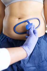 our coolsculpting elite results are blowing us away