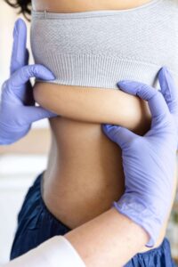 why coolsculpting elite doesn’t leave you with sagging skin