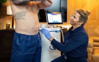 why coolsculpting elite makes the best gift