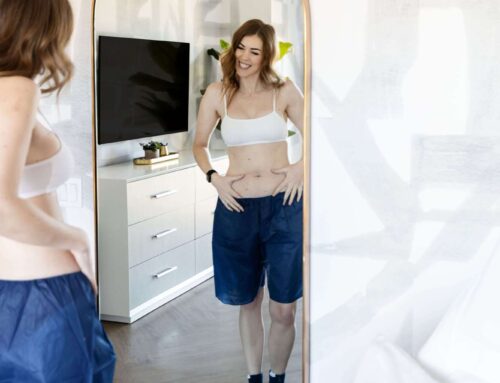 Can You Freeze Your Fat Off At Home?