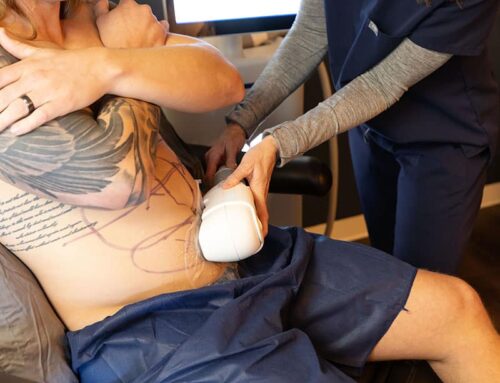 Achieving Your Dream Body with Organic Weight Loss and CoolSculpting