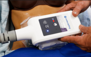 Image is about Benefits of CoolSculpting: Why Choose This Fat Reduction Treatment by Bodify Call Today