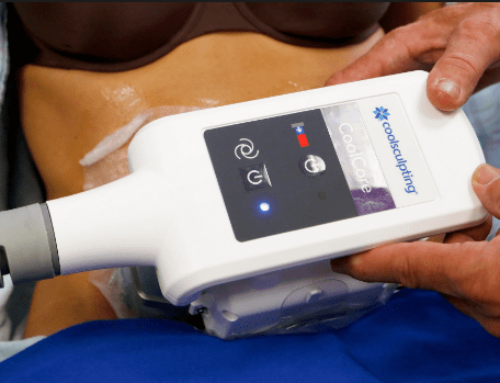 The Truth about CoolSculpting: Why Safe and Effective Treatment Matters