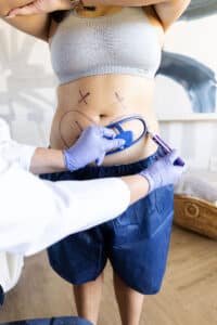 coolsculpting the worthwhile financial investment for body transformation
