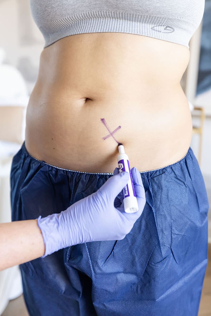 coolsculpting at bodify stop wasting money on ineffective fat loss solutions