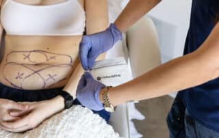 transform your body with coolsculpting and semaglutide