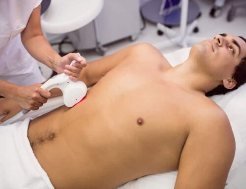 CoolSculpting for Men: Breaking Down Gender Stereotypes With The Bodify