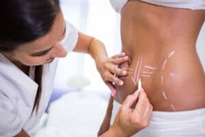 the 5 most commonly treated areas with coolsculpting