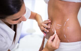 the 5 most commonly treated areas with coolsculpting