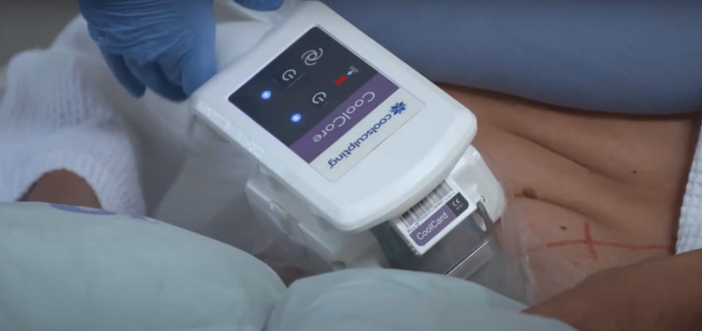 Find out how long CoolSculpting results last and how to maintain them. Explore this effective fat reduction solution. Schedule your consultation today!