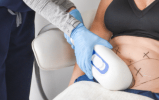 CoolSculpting at Bodify Scottsdale offers a safe, non-surgical fat-reduction option for post-pregnancy body contouring. Schedule a consultation today to restore your confidence! Call 480-530-0030 now!