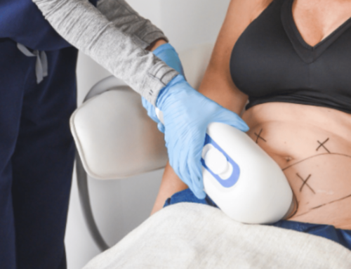 Can CoolSculpting Help with Post-Pregnancy Fat Reduction in Scottsdale?