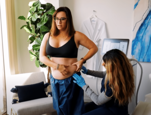 Why CoolSculpting Elite Is the Top Choice for Small Fat Pocket Reduction in Glendale