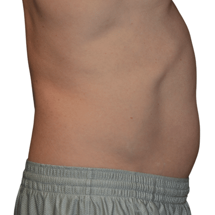 rectangle 588 1 1
