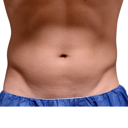 rectangle 588 1 1