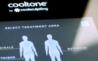 CoolTone device delivering magnetic pulses to abdominal muscles during a treatment session.