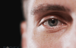 Morpheus8 treatment under the eyes at Bodify MedSpa to reduce puffiness and dark circles – call today for your custom consultation.