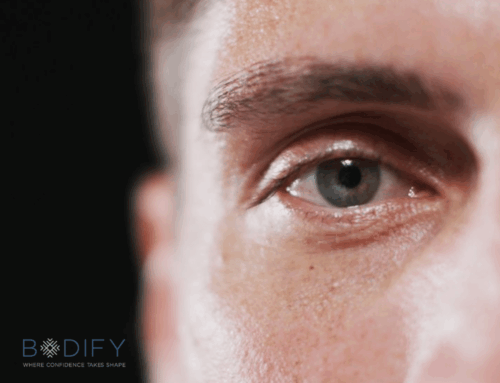 How Morpheus8 Helps Eliminate Puffy Eyes and Dark Circles