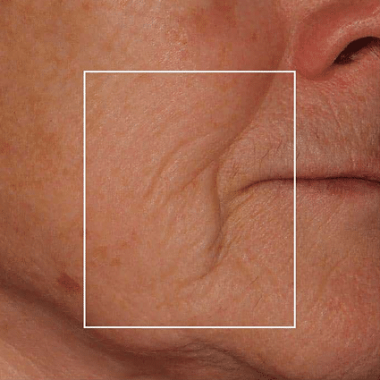 rectangle 588 1 1