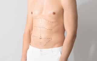 A confident man after CoolTone treatment at Bodify’s ManCave. Learn how men benefit from non-surgical muscle toning. Discover results and book your session with Bodify today.