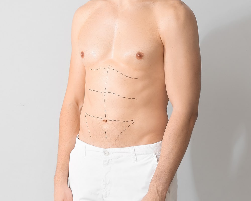 How CoolTone Helps Men Build Muscle and Confidence — Insights from Bodify’s ManCave A confident man after CoolTone treatment at Bodify’s ManCave. Learn how men benefit from non-surgical muscle toning. Discover results and book your session with Bodify today.