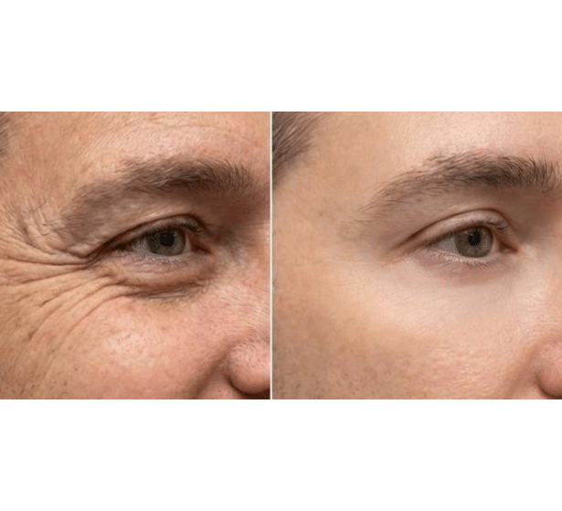 eye boost b and a eye boost b and a
